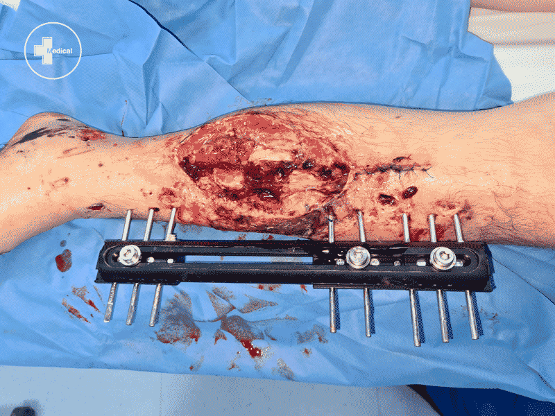 20210401 073154 copia