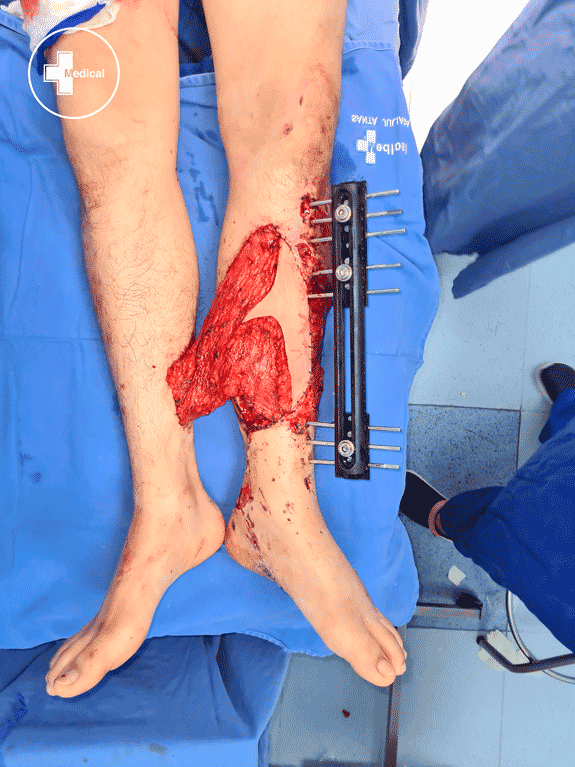 20210408 113149 copia