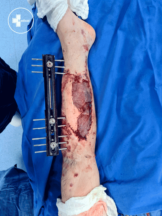 20210609 160003 copia