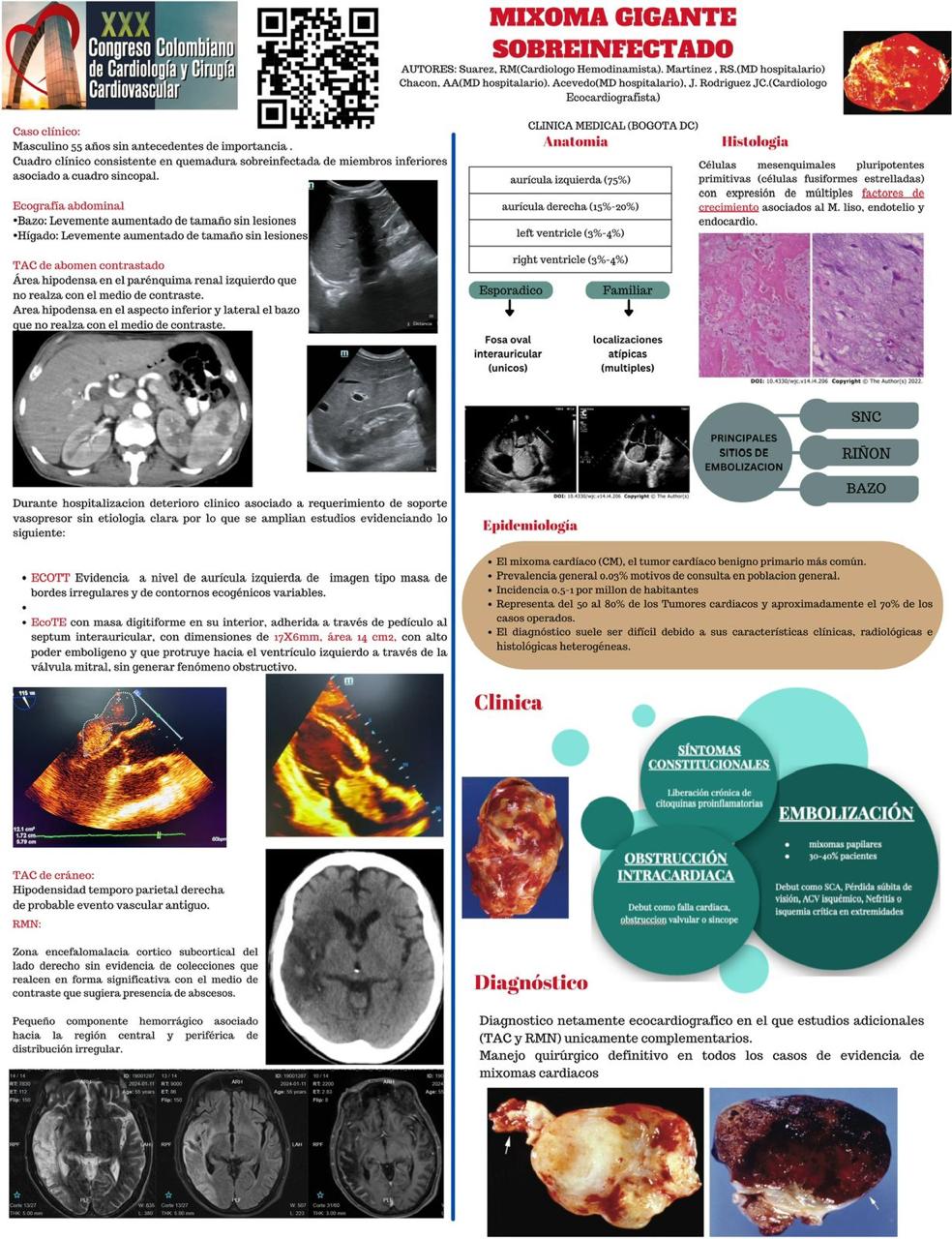 MixomaClinicaMedical