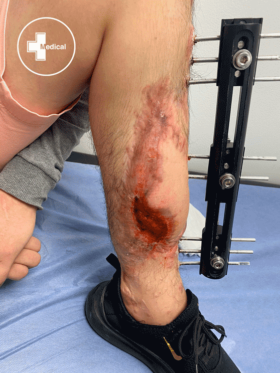 WhatsApp Image 2022 05 19 at 8.58.33 AM 1 copia